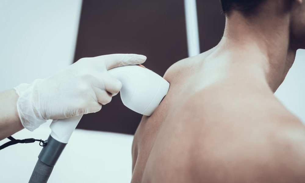 רשלנות בטיפול להסרת שיער - רשלנות רפואית ניתוחי לייזר